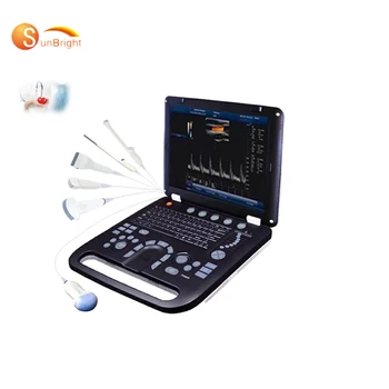 15-inčni laptop profesionalni акушерский ginekološki vaskularni hit prodaje 3D-u boji допплеровского zdravstveno ultrazvučni skener za laptop