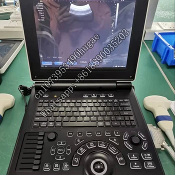 Ultrazvučni skener e20, prijenosni color doppler 3d prijenosni ultrazvučni aparat, cijena